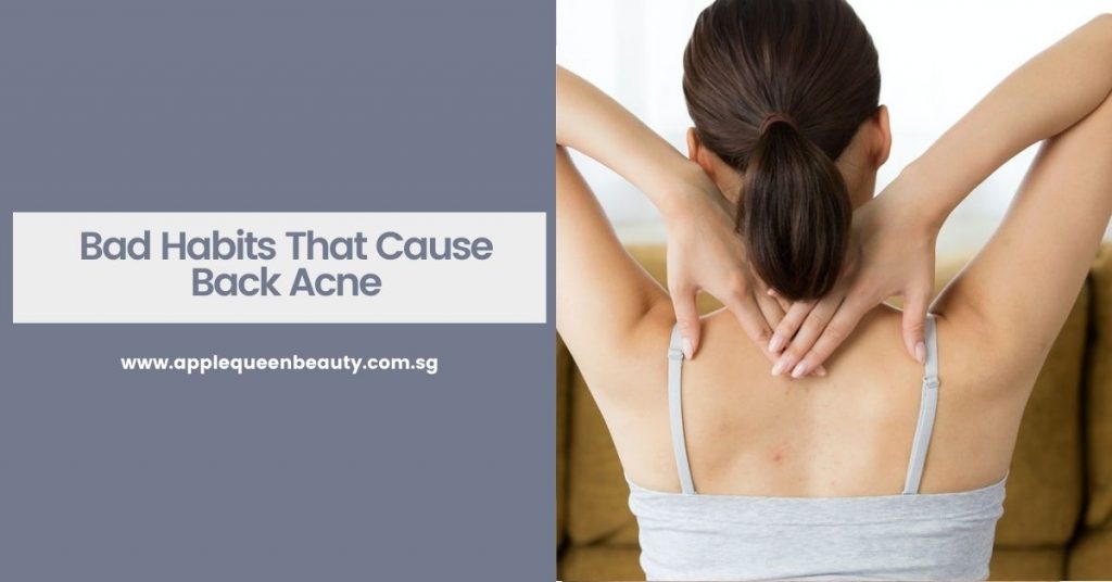Bad Habits That Cause Back Acne
