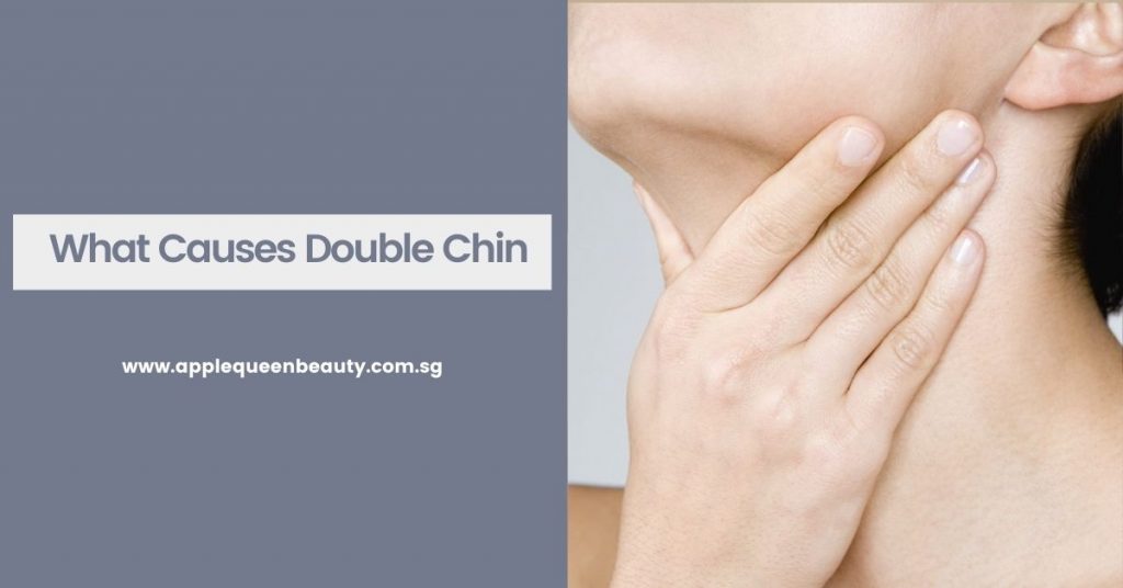 What Causes Double Chin