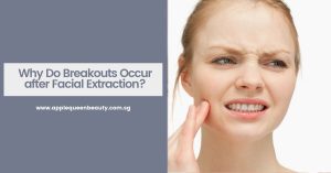 Why Do Breakouts Occur after Facial Extraction Featured Image