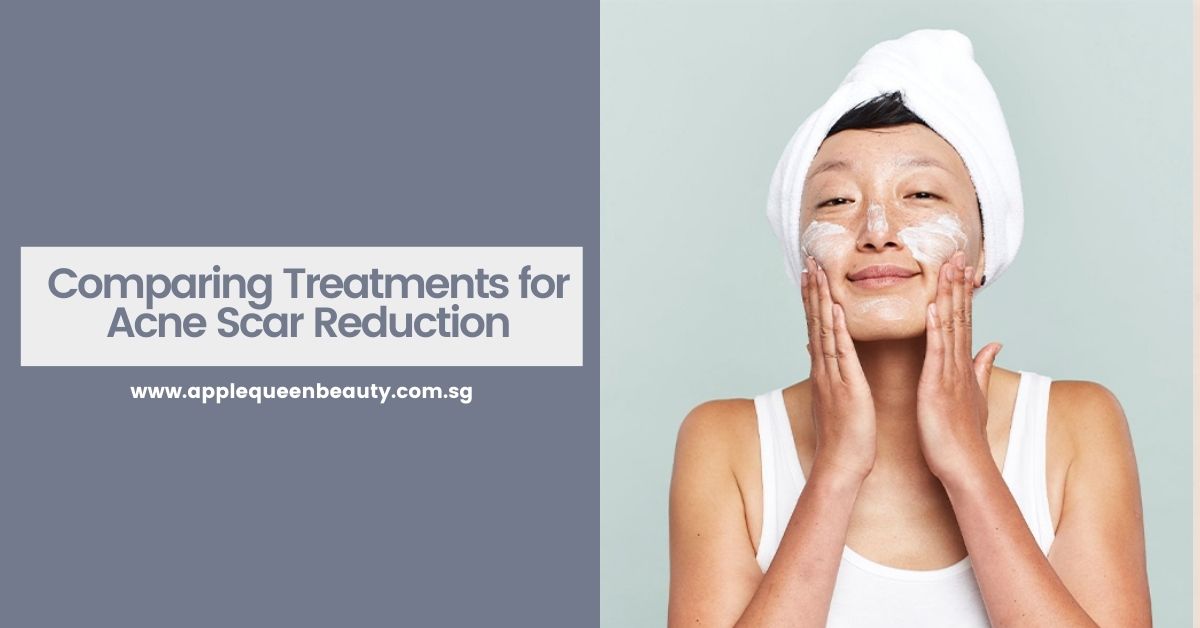 Comparing Treatments for Acne Scar Reduction