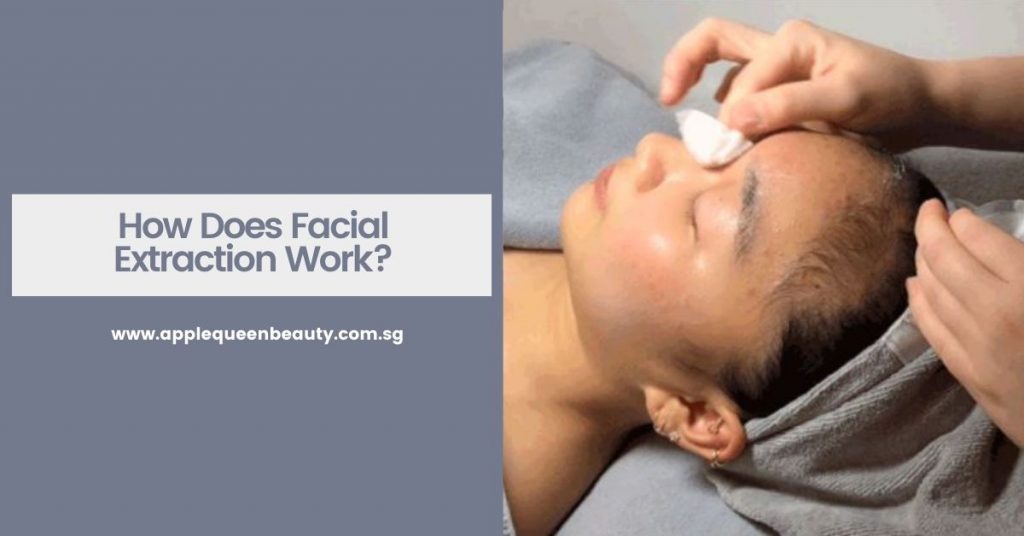 How Does Facial Extraction Work
