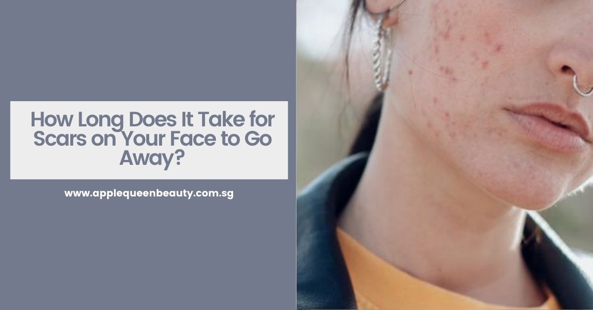 How Long Does It Take for Scars on Your Face to Go Away Featured Image