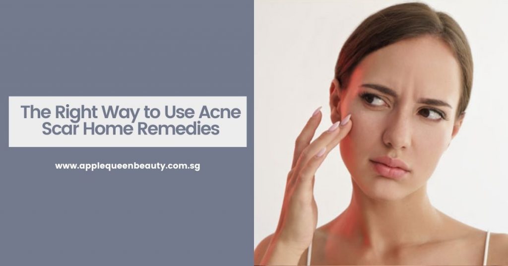 The Right Way to Use Acne Scar Home Remedies Featured Image