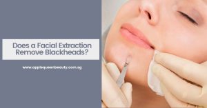 Does a Facial Extraction Remove Blackheads Featured Image