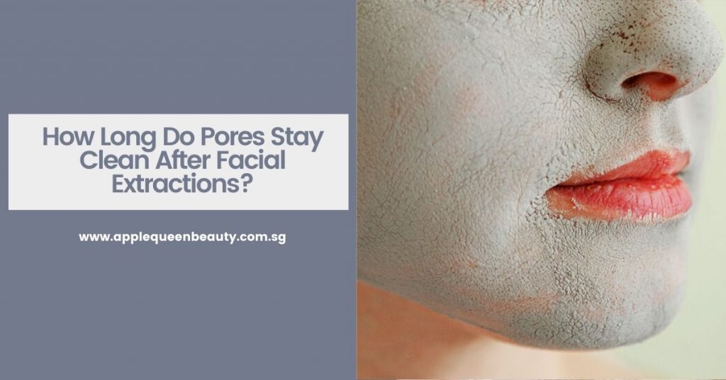 How Long Do Pores Stay Clean After Facial Extractions Featured Image