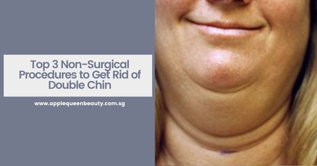 Top 3 Non Surgical Procedures to Get Rid of Double Chin Featured Image