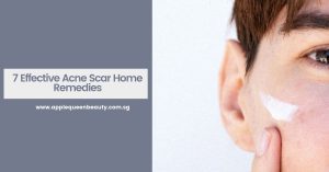 7 Effective Acne Scar Home Remedies Featured Image