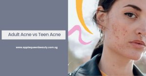 Adult Acne vs Teen Acne Featured Image