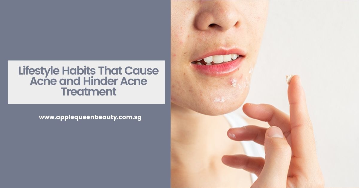 Lifestyle Habits That Cause Acne and Hinder Acne Treatment Featured Image