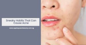 Sneaky Habits That Can Cause Acne Featured Image