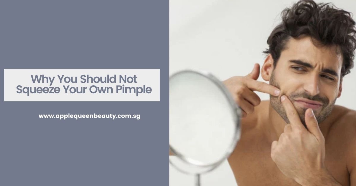Why You Should Not Squeeze Your Own Pimple