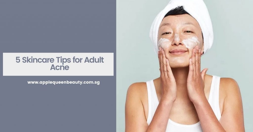 5 Skincare Tips for Adult Acne Featured Image