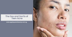 The Dos and Donts of Teen Acne